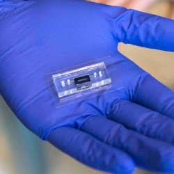 The microfluidic DNA "lab-on-chip" device.